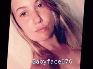 Babyface076