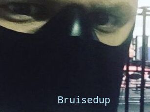 Bruisedup