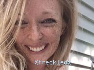 Xfreckledx
